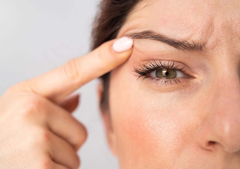 Göz Seğirmesi Her Zaman Masum Olmayabilir: Blefarospazm Nedir?